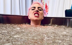 Lady GaGa Shares Pic of Enduring Ice Bath After Scary Onstage Fall in Las Vegas