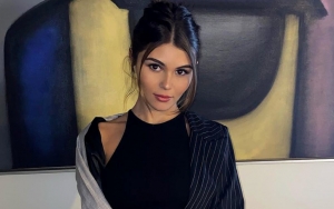 Olivia Jade Shows Injuries From 'Crazy' Accident After Fainting in the Bathroom