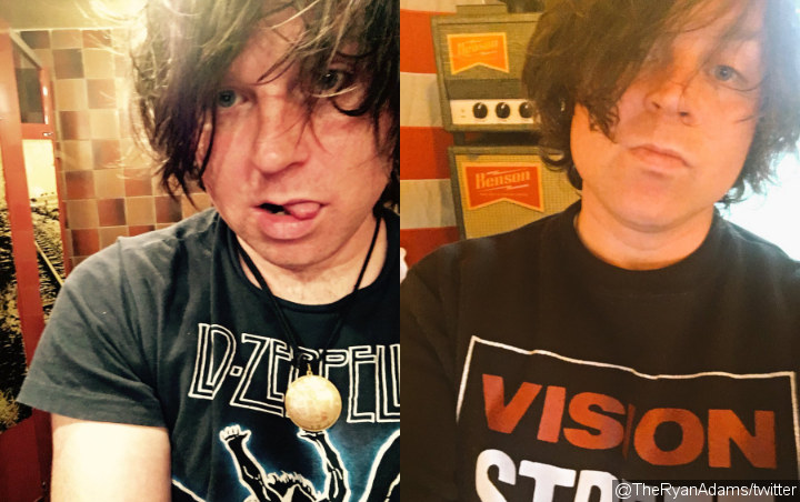 Ryan Adams Celebrates 60-Day Sobriety With a Look Back at 2018