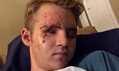 'American Horror Story' Star Dalton Gray Is Seriously Injured in Car Crash, Thanks Fans for Support