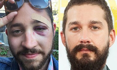 This Man Gets Punched for Looking Exactly Like Shia LaBeouf. What's His Fault?