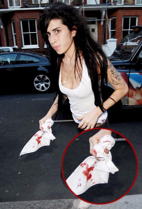 Winehouse Is Out Of Again help winehouse cut herself again Winehouse Is Out Of Again help winehouse cut herself again