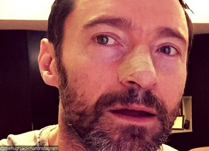 Hugh Jackman Is Treated for Skin Cancer Again, Reminds Fans to 'Wear Sunscreen'