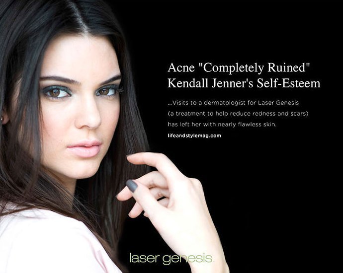 Kendall Jenner Sues Skincare Company for $10 Million