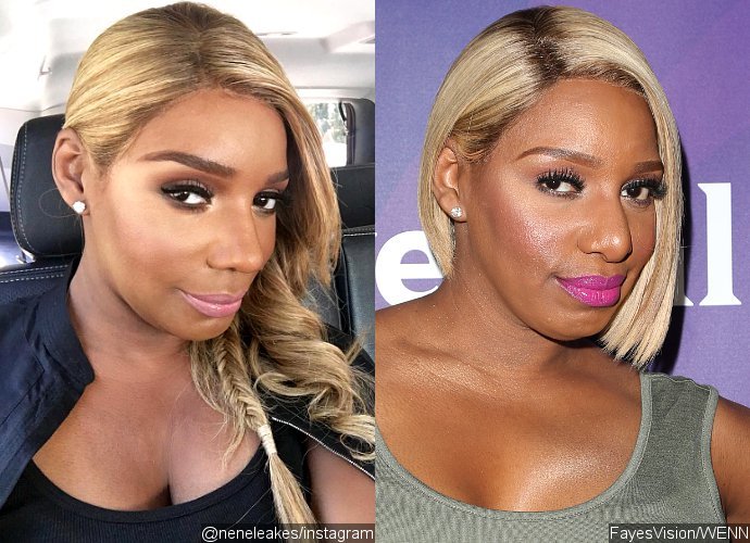 NeNe Leakes Sparks Nose Job Speculations in Latest Selfies