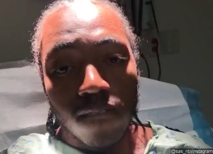 'Love and Hip Hop' Star Sas Gets Shot in the Head. See the Gruesome Photo and Video