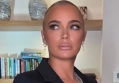 Teddi Mellencamp Bares Scars From Brain Surgery on Red Carpet Amid Stage 4 Cancer Battle