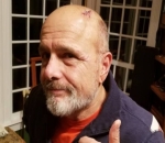 Joe Pantoliano Recovering in Hospital After Getting Hit by a Car