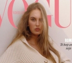 Model Romee Strijd Opens Up About Her Battle With Polycystic Ovary Syndrome