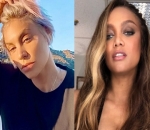 'ANTM' Alum Lisa D'Amato Accuses Tyra Banks of Using Her 'Childhood Trauma' Against Her