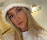 Perrie Edwards Wanted to Get Rid of Her Freckles With 'Acid Peel' When She Was Younger