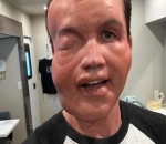Rob McElhenney's Fans Poke Fun at Him Due to His Shocking Allergic Reaction