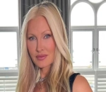 Caprice Disgusted by Her Own Look After Botched Cosmetic Procedure