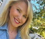 Christie Brinkley Posts Pics of Her Scar After Having Skin Cancer Lesion Removed From Face