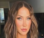 Kaitlyn Bristowe Inspires Fans to Undergo Eye Lift Surgery After Sharing Video of Bruises