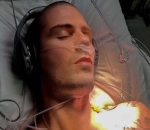 Max George Has Tough Recovery After Second Heart Surgery: 'Coughing Up Blood for Five Days'  