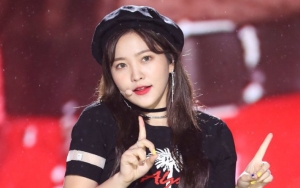 Easily Sick, Red Velvet's Yeri Needs IV Drips During Every Promotion
