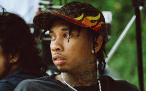 Tyga Promotes Hair Plug Treatment Amidst Nicki Minaj Twitter Dispute