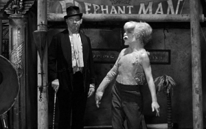 'Elephant Man' Series Slammed for Not Casting Disabled Actor
