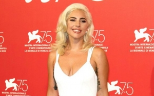 Lady GaGa Accused of Having Multiple Plastic Surgeries - How She Makes It Subtle?