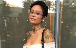 Kehlani's 'Different' Look Is Not Because of Plastic Surgery