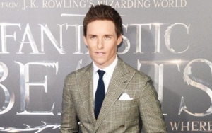 Eddie Redmayne Has to Wear Medical Boot After Spraining Ankle on Set