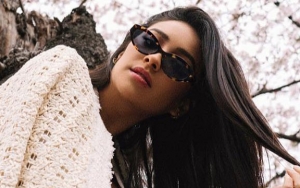 Shay Mitchell Shows Off Her 'New Look' After Losing Tooth
