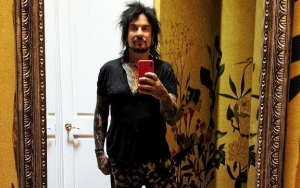 Nikki Sixx Jokes About Having Five Cadaver Parts in His Body After Shoulder Surgery