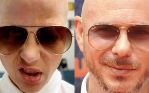 Selma Blair Likens Her Bald Look to Pitbull Amid MS Battle