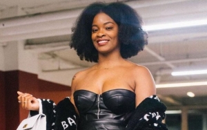 Ari Lennox Vows to Never Get Plastic Surgery After Being Told She Needs a Nose Job