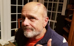 Joe Pantoliano Recovering in Hospital After Getting Hit by a Car