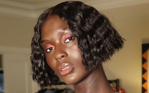 Jodie Turner-Smith Makes Use of Breast Milk to Treat Postpartum Acne