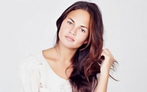 Chrissy Teigen Goes Topless to Offer a Look at Painful Sunburn