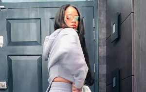 Rihanna Steps Out With Bruises on Her Face, Reps Says She's 'Completely Fine'