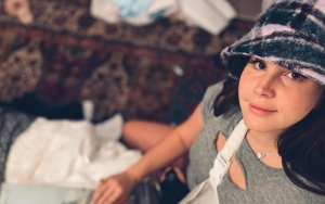 Lana Del Rey Injures Her Arm Following Ice Skating Accident