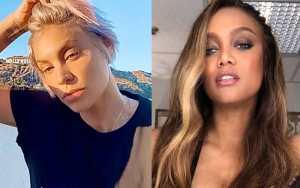 'ANTM' Alum Lisa D'Amato Accuses Tyra Banks of Using Her 'Childhood Trauma' Against Her