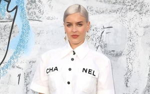 Anne-Marie Says No to Botox Due to 'Extreme' Facial Expressions