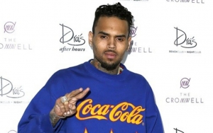 Graphic Photos of Chris Brown's Alleged Dog Attack Victim Emerge
