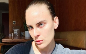 Tallulah Willis Feels Like an 'Alien' Goddess After Dealing With Skin Problems