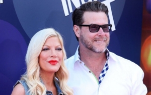 Dean McDermott Ditches Wedding Ring Amid Tori Spelling Split Rumors