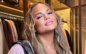 Chrissy Teigen Reveals Stunning Transformation After Eyebrow Transplant Surgery