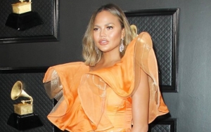 Chrissy Teigen Claps Back at Criticism Over 'Out of Touch' Eyebrow Transplant Surgery Post