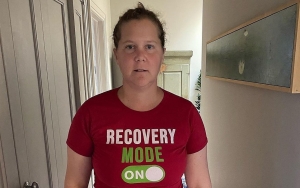 Amy Schumer Gets Rid of Face Fillers for Making Her 'Look Like Maleficent'