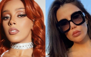 Doja Cat Rips YouTuber Lorry Hill for Accusing of Getting Plastic Surgery