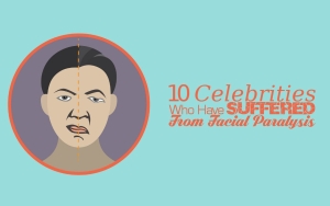 10 Celebrities Who Have Suffered From Facial Paralysis