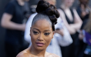Keke Palmer Further Damages Her Eyes After Trying Controversial Meditative Practice
