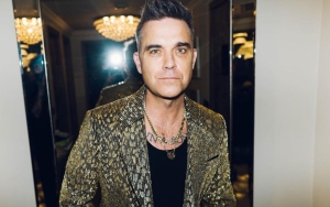 Robbie Williams Is Losing Hair and 'Embracing' It