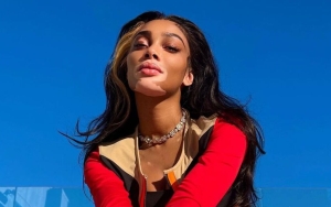 Winnie Harlow Tired of Being Known as 'Model With Vitiligo'