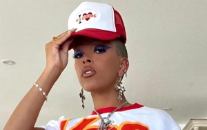 Doja Cat Turns Fans Off With Her Latest Bold Style
