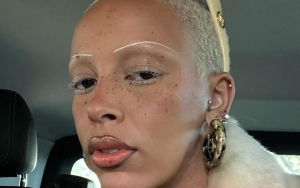 Doja Cat Embraces Her Freckles in New Selfies
